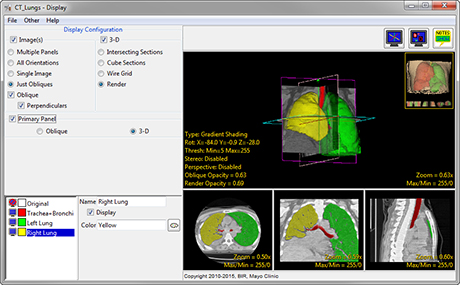 Analyze 15.0 Display Tools - AnalyzeDirect