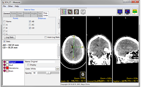 Analyze 14.0 Measurement Tools - AnalyzeDirect
