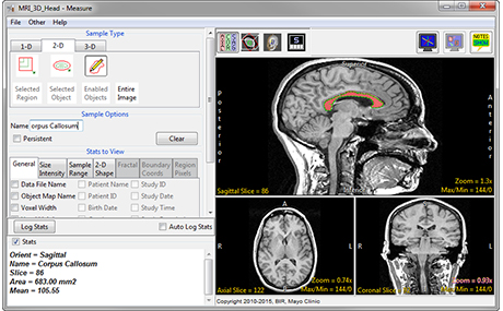 Analyze 15.0 Measure Tools - AnalyzeDirect