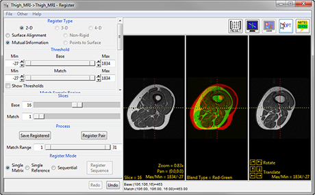 Analyze 14.0 Registration Tools - AnalyzeDirect