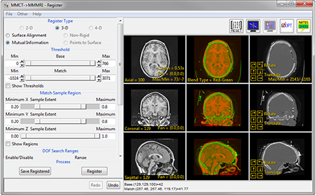 Analyze 15.0 Register Tools - AnalyzeDirect