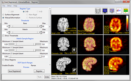 Analyze 14.0 Registration Tools - AnalyzeDirect