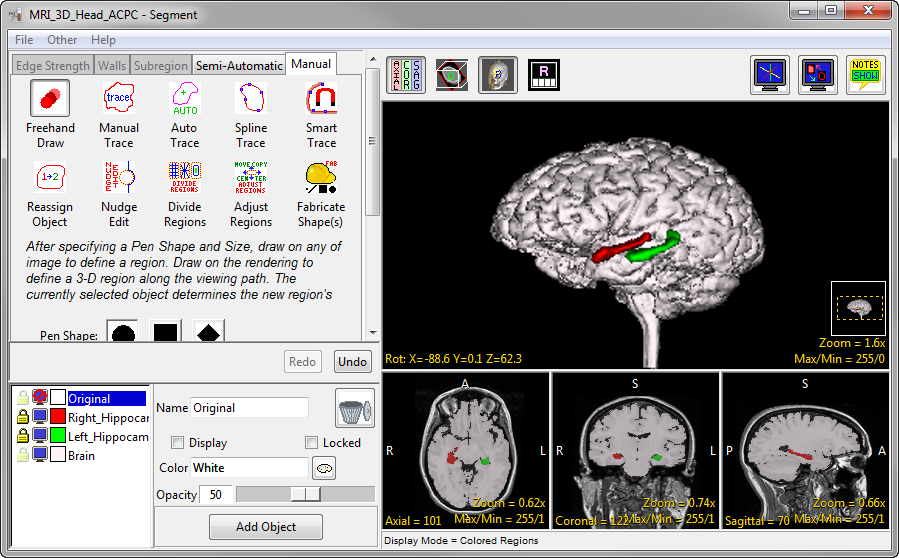 Analyze 15.0 Segment Tools - AnalyzeDirect