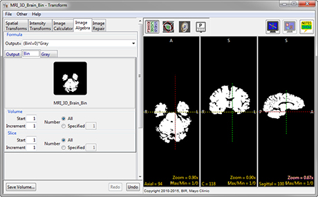 Analyze 14.0 Transform Tools - AnalyzeDirect