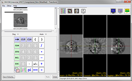 Analyze 14.0 Transform Tools - AnalyzeDirect