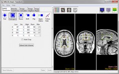 Analyze 14.0 - AnalyzeDirect