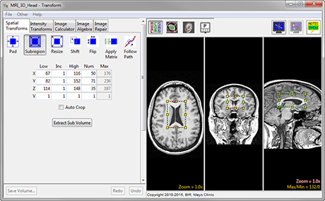 Analyze 14.0 - AnalyzeDirect