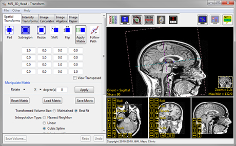 Analyze 14.0 Transform Tools - AnalyzeDirect
