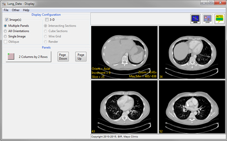 Analyze 14.0 Display Tools - AnalyzeDirect